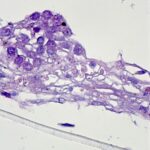 Fibrin_gel